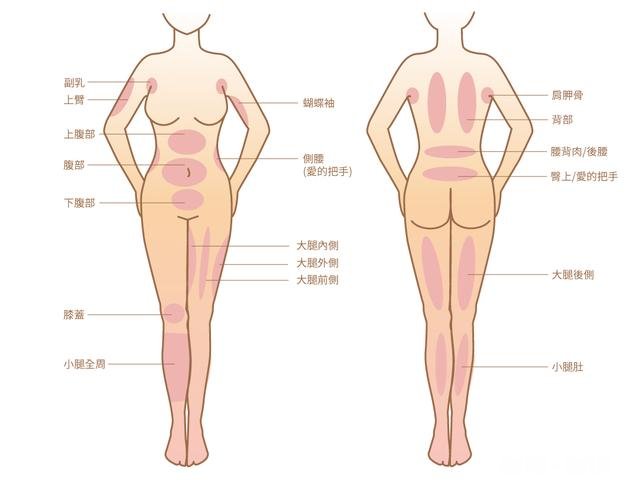 吸脂减肥适合哪些人