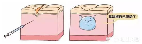 如何让玻尿酸维持时间更长