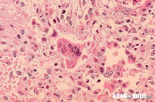 什么是P4实验室