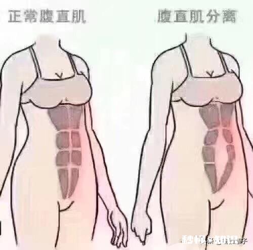 产后如何快速恢复大肚子，生完娃医生为啥让我们用收腹带，真的有用吗