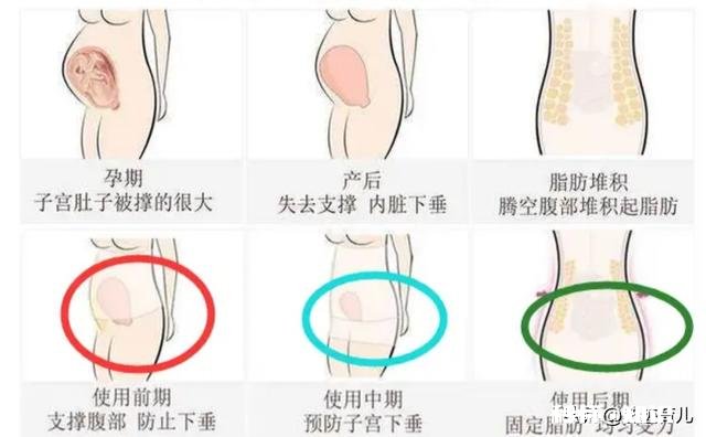 产后如何快速恢复大肚子，生完娃医生为啥让我们用收腹带，真的有用吗