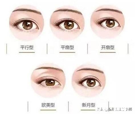 双眼皮手术失败了什么心情