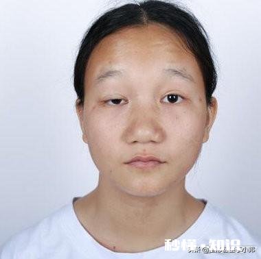 25岁，额头皱纹越来越深，用眼霜护理怎么样