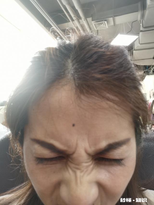 25岁，额头皱纹越来越深，用眼霜护理怎么样