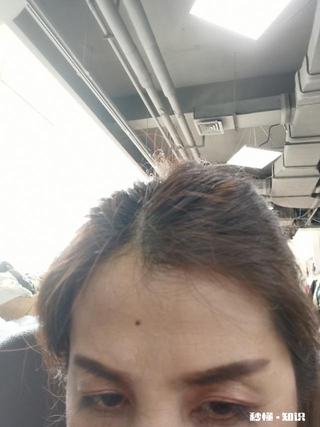 25岁，额头皱纹越来越深，用眼霜护理怎么样