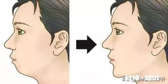 垫下巴适合哪些人