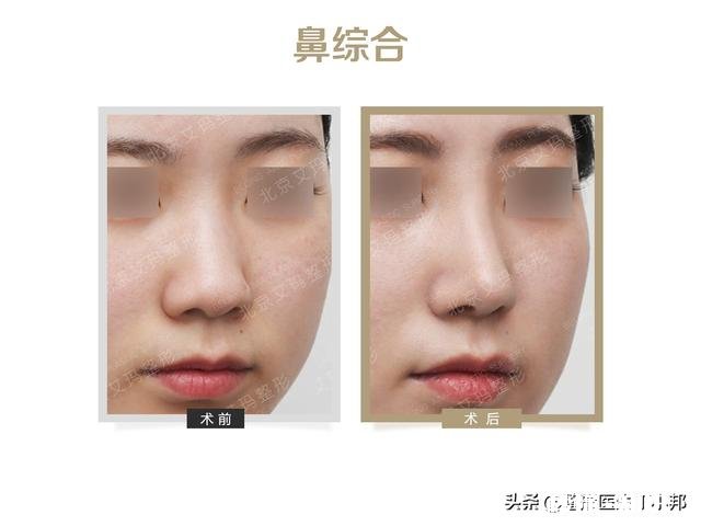 既想变美,又不想别人看出来整形?这是什么心理