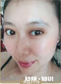 既想变美,又不想别人看出来整形?这是什么心理