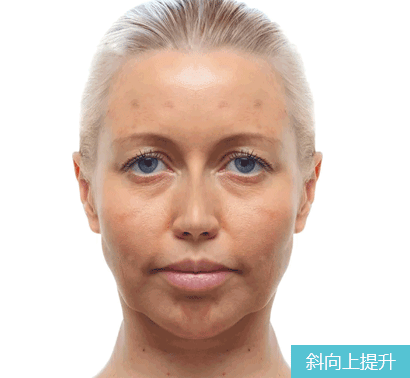 大V线和蛋白线的区别