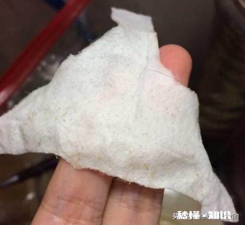 黑头到底如何去有什么大咖经验可以分享