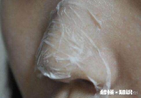 黑头到底如何去有什么大咖经验可以分享