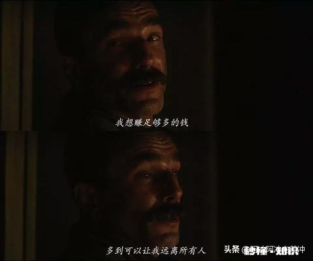 为什么现在的90后都开始脱发了