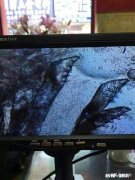 为什么现代女性很多脸上背上都长痘痘