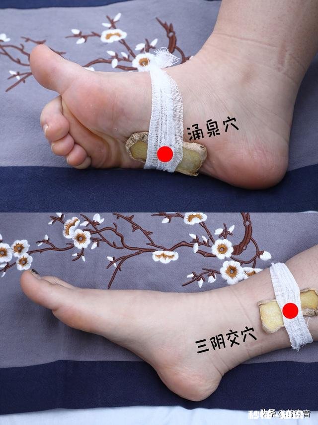 为什么现代女性很多脸上背上都长痘痘