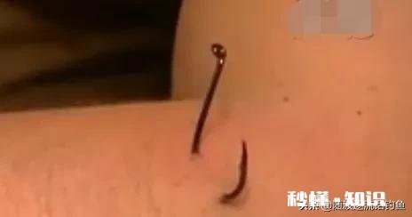 钓鱼时被魚钩扎手，你会去打破伤风针吗