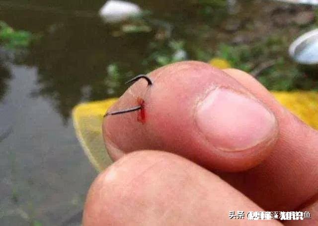 钓鱼时被魚钩扎手，你会去打破伤风针吗