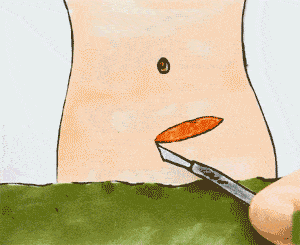 很多产妇直接选择剖腹产，但是很多想顺都没办法顺，这是为什么呢