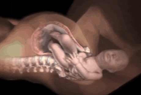 很多产妇直接选择剖腹产，但是很多想顺都没办法顺，这是为什么呢