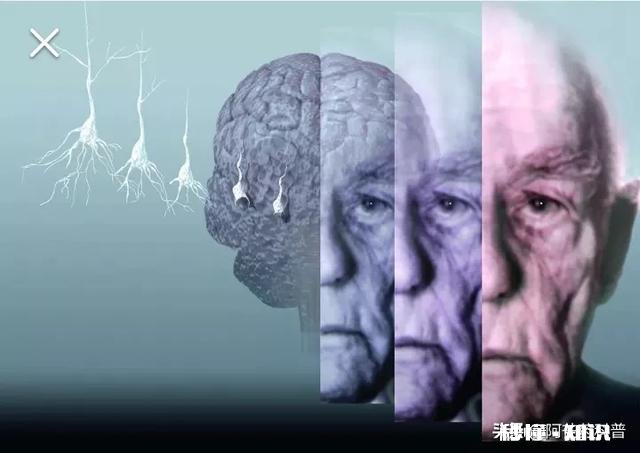 家属应如何护理阿尔茨海默病患者