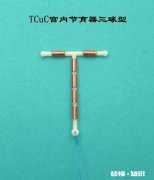 6070后的女人，当时计划生育需要结扎，有老公愿意为你承担吗