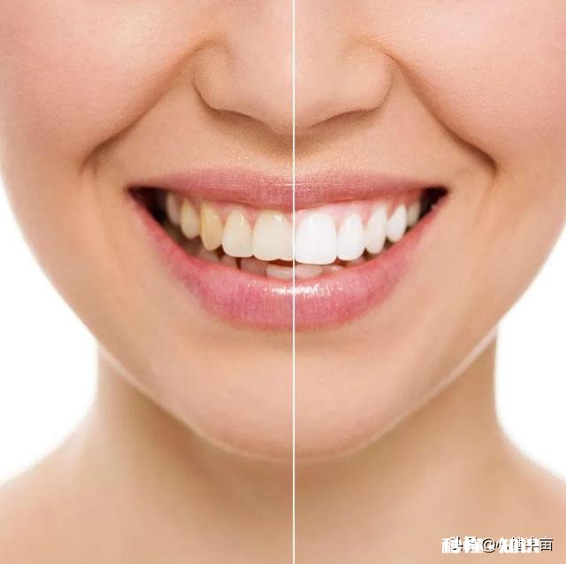 因拥有一口坏牙而产生自卑心理怎么办