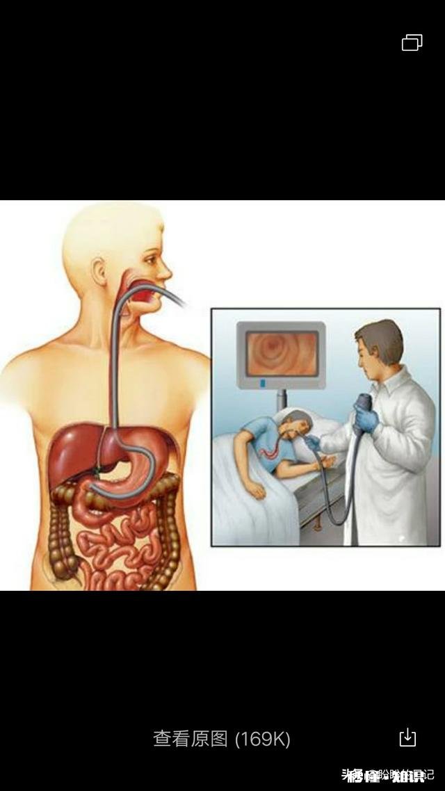 普通胃镜可以忍受吗是不是特别难受