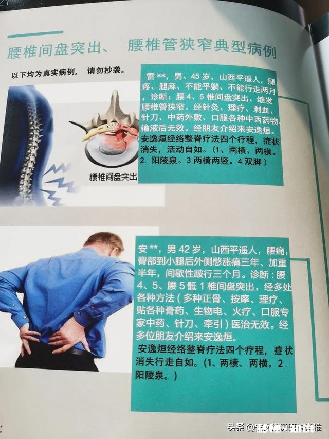 正骨对腰椎间盘突出有效果吗是什么原理呢