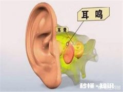 耳鸣是什么原因引起的如何改善呢