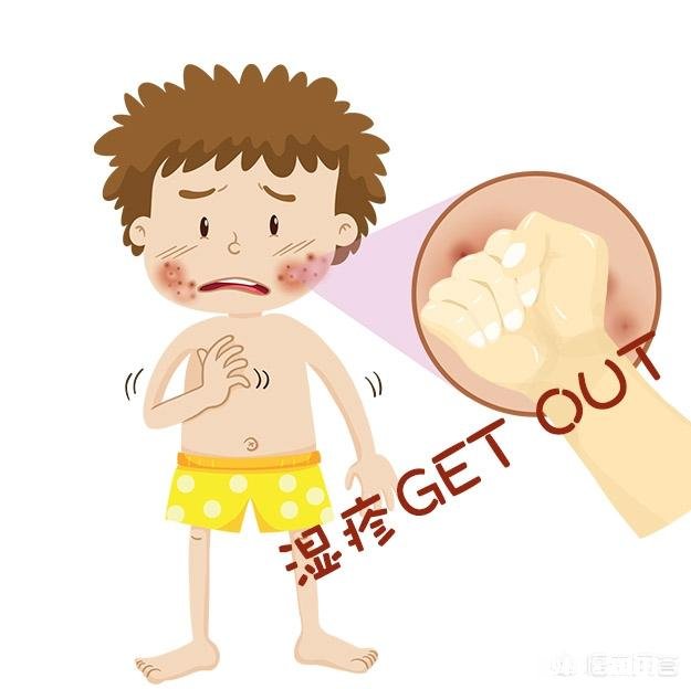 宝宝湿疹应如何预防和护理