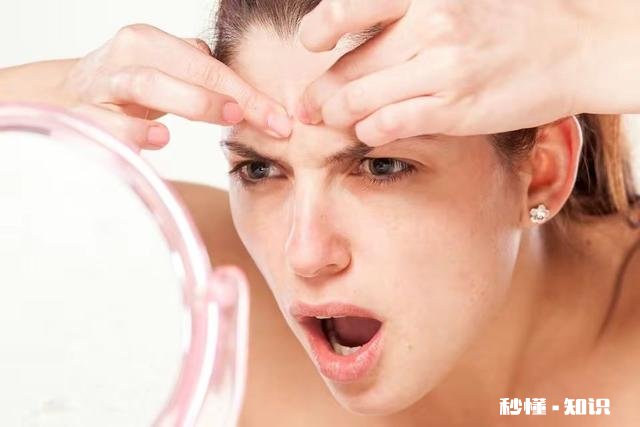 痘痘有那么难去掉吗该怎么祛痘