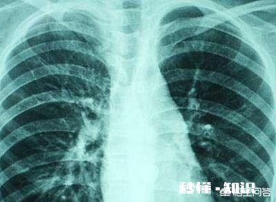 为什么小儿总是反复咳嗽，发热引起肺炎，吃药打针一点效果都没有，如何是好