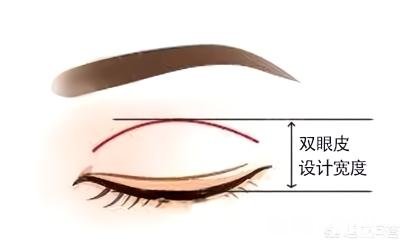 双眼皮割多宽最好看有什么好建议