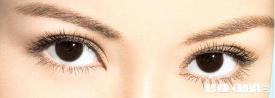 双眼皮割多宽最好看有什么好建议