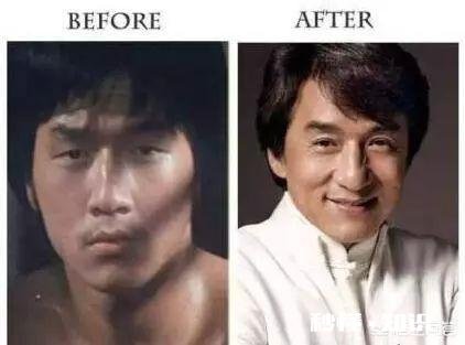 双眼皮割多宽最好看有什么好建议