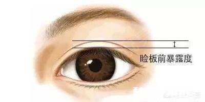 双眼皮割多宽最好看有什么好建议