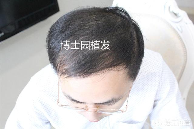 关于「男生自己吹头发技巧」,问问大家怎么看