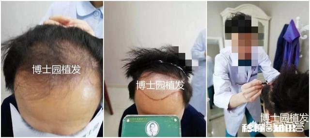 关于「男生自己吹头发技巧」,问问大家怎么看