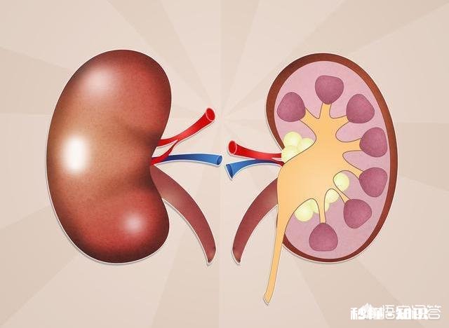 尿结石会对肾造成损伤吗