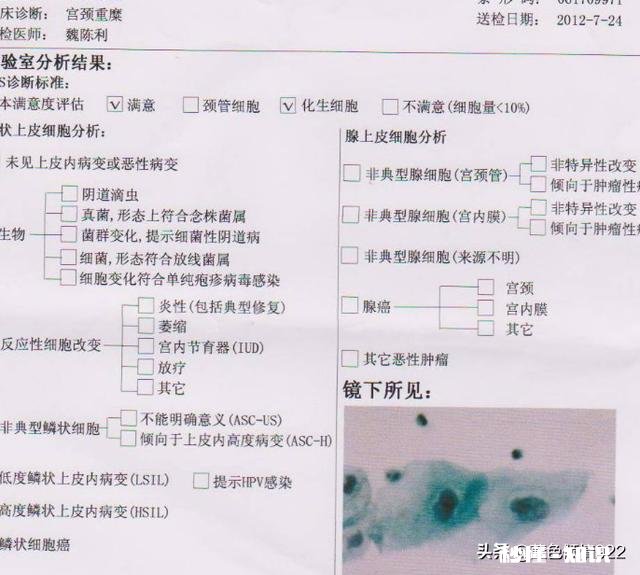 为什么有的人每年体检还是患了宫颈癌