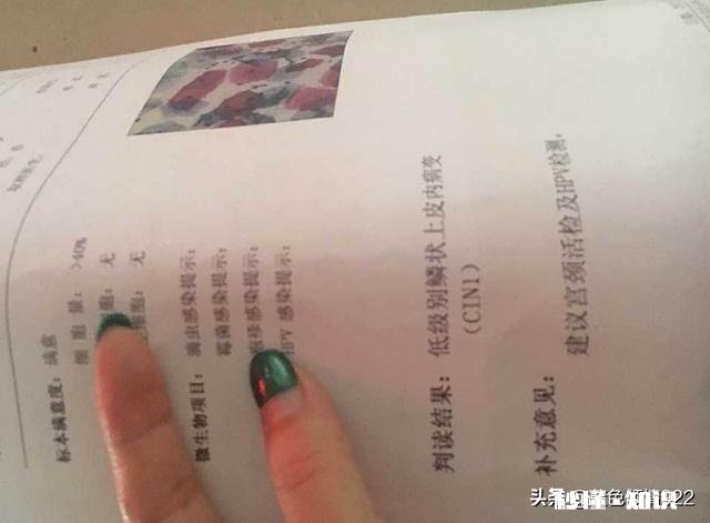 为什么有的人每年体检还是患了宫颈癌