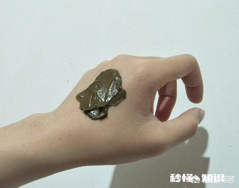 “闭口粉刺”是由于什么习惯造成的能祛除吗