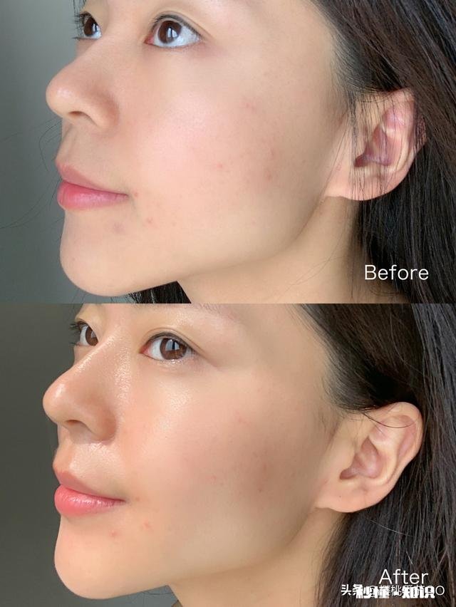 有必要用精华液吗什么时候开始用比较好