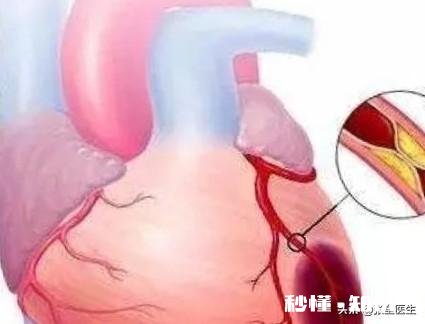 心脏不好，应该在饮食注意什么哪些运动对可以锻炼心脏