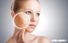 为什么会皮肤干，该如何护理