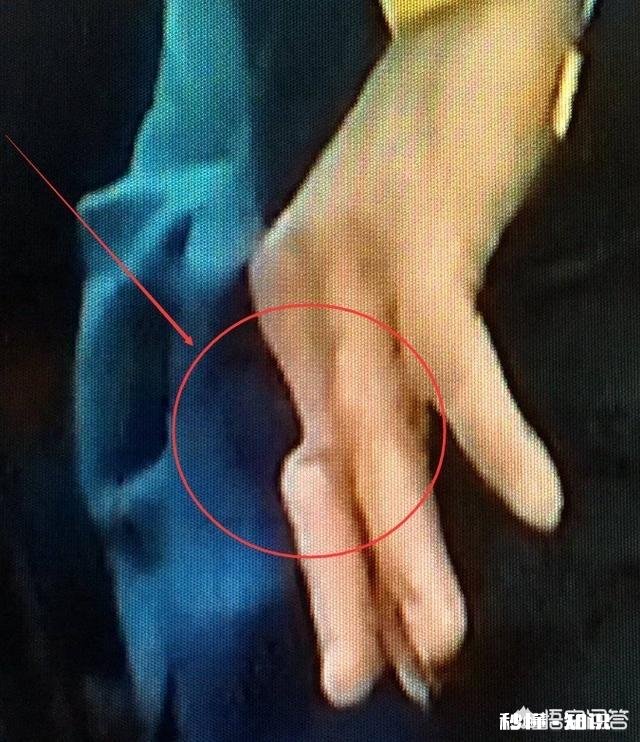 库里手指肿成那样！为什么带球还那么灵活