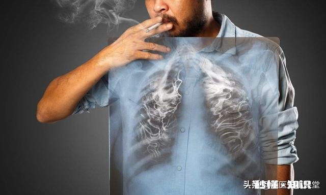 早期肺癌，除了手术外还可以怎么治疗