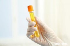 尿酸高是由什么引起的