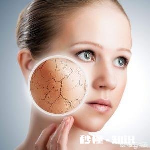 皮肤干是因为自身含水量低吗，应该怎么办