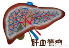 报告下面提示写:肝脏右叶均质性高回声灶，血管瘤与其他鉴别。医生说没事，真没事吗