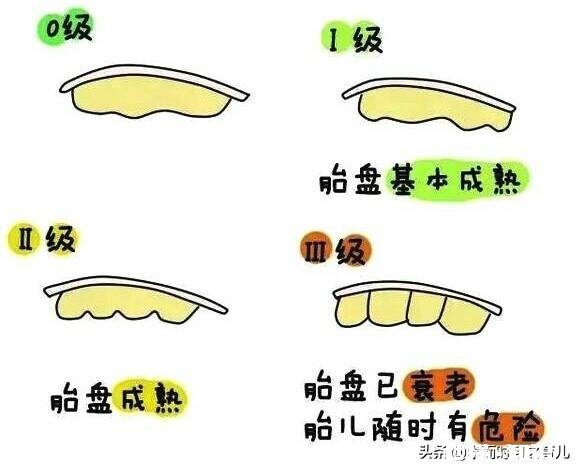 孕29周+2检查胎盘成熟度2级，会不会宝宝比预产期提前出来